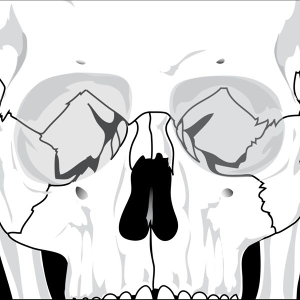 liftarn Human skull 2 Thumbnail